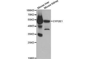 Western blot analysis of extracts of various cell lines, using CYP2E1 antibody. (CYP2E1 Antikörper  (AA 234-493))