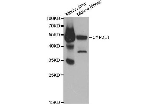 CYP2E1 anticorps  (AA 234-493)
