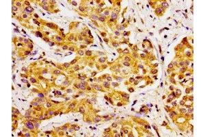 Immunohistochemistry (IHC) image for anti-Cytochrome P450, Family 27, Subfamily A, Polypeptide 1 (CYP27A1) (AA 290-407) antibody (ABIN7170770)