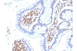 Formalin-fixed, paraffin-embedded human Colon stained with MAPK14 Mouse Monoclonal Antibody (CPTC-MAPK14-1). (MAPK14 Antikörper)