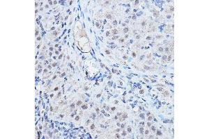 Immunohistochemistry of paraffin-embedded rat ovary using DGCR8 Rabbit pAb (ABIN7266761) at dilution of 1:200 (40x lens). (DGCR8 Antikörper)