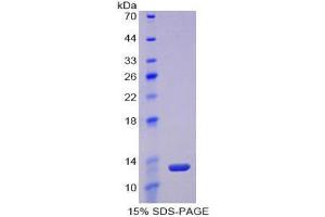 SDS-PAGE (SDS) image for Lysyl Oxidase-Like 2 (LOXL2) (AA 53-160) protein (His tag) (ABIN1877947)