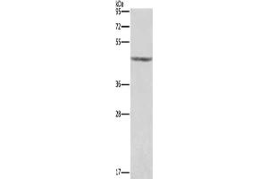Gel: 8 % SDS-PAGE, Lysate: 40 μg, Lane: Human placenta tissue , Primary antibody: ABIN7191188(KCNJ9 Antibody) at dilution 1/350, Secondary antibody: Goat anti rabbit IgG at 1/8000 dilution, Exposure time: 1 second (KCNJ9 Antikörper)