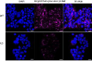 Immunocytochemical staining of HeLa cells using Amyloid beta precursor protein antibody (ABIN7797593), 1:1,000), Top panel: wild-type (WT), Bottom panal: Amyloid beta precursor protein shRNA knockdown (KD). (Rekombinanter APP Antikörper)