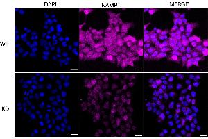Immunocytochemical staining of HeLa cells using NAMPT antibody (ABIN7799595), 1:1,000), Top panel: wild-type (WT), Bottom panal: NAMPT shRNA knockdown (KD). (Rekombinanter NAMPT Antikörper)