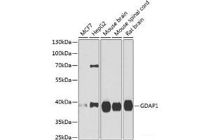 Western blot analysis of extracts of various cell lines using GDAP1 Polyclonal Antibody at dilution of 1:1000. (GDAP1 Antikörper)