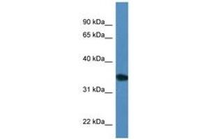 Image no. 1 for anti-Uridine Phosphorylase 2 (UPP2) (AA 200-249) antibody (ABIN6746297) (UPP2 Antikörper  (AA 200-249))