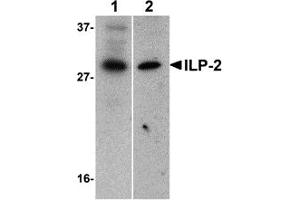 Western Blotting (WB) image for anti-Baculoviral IAP Repeat-Containing 8 (BIRC8) (N-Term) antibody (ABIN1031417) (ILP-2 Antikörper  (N-Term))