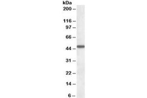 Western blot testing of human liver lysate with AADAT antibody at 1ug/ml. (AADAT Antikörper)