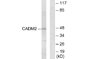 Western blot analysis of extracts from HepG2 cells, using CADM2 antibody. (CADM2 Antikörper)