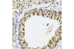 Immunohistochemistry of paraffin-embedded mouse lung using STAT3 antibody (ABIN1876697) at dilution of 1:100 (40x lens).