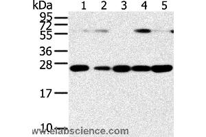 Western blot analysis of Human placenta tissue and hela cell, hepg2 cell and human fetal liver tissue, A549 cell and human normal kidney tissue, using SNAP23 Polyclonal Antibody at dilution of 1:400 (SNAP23 Antikörper)