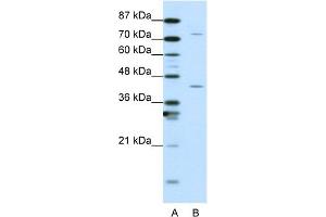 WB Suggested Anti-TCEA1 Antibody Titration:  1. (TCEA1 Antikörper  (N-Term))