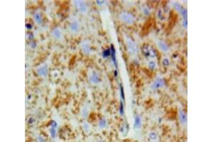 IHC-P analysis of Brain tissue, with DAB staining. (DVL2 Antikörper  (AA 78-250))