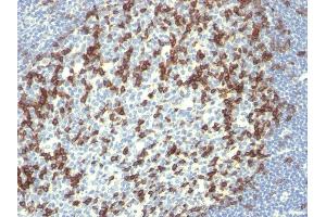 Formalin-fixed, paraffin-embedded human Tonsil stained with PD1 (CD279) Monoclonal Antibody (PDCD1/922). (PD-1 Antikörper)