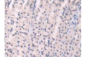 Immunohistochemistry (IHC) image for anti-Uncoupling Protein 1 (Mitochondrial, Proton Carrier) (UCP1) (AA 179-296) antibody (ABIN7436078)