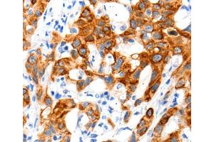 Immunohistochemistry (IHC) image for anti-Solute Carrier Family 2 (Facilitated Glucose Transporter), Member 11 (SLC2A11) antibody (ABIN2426005)