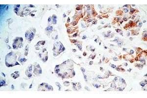 Human pancreas tissue was stained by Rabbit Anti-AdrenomeduIIiln-Gly (Human) Antibody (Adrenomedullin-Gly Antikörper)