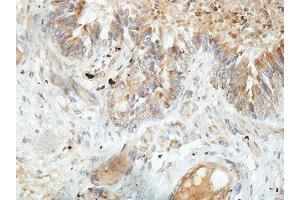 IHC analysis of formalin-fixed paraffin-embedded fetal lung, using TTC25 antibody (1/100 dilution).