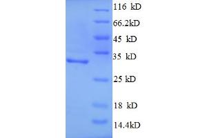 SDS-PAGE (SDS) image for Superoxide Dismutase 2, Mitochondrial (SOD2) (AA 1-25), (full length) protein (GST tag) (ABIN5710708) (SOD2 Protein (AA 1-25, full length) (GST tag))