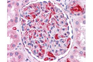 ApoE antibody was used for immunohistochemistry at a concentration of 4-8 ug/ml. (APOE Antikörper  (N-Term))