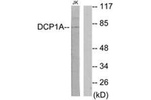 Western blot analysis of extracts from Jurkat cells, using DCP1A Antibody. (DCP1A Antikörper  (AA 111-160))