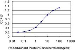 Detection limit for recombinant GST tagged MAK is approximately 0. (MAK Antikörper  (AA 358-457))
