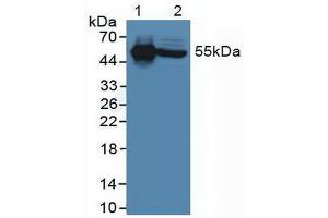 Figure. (IL-6 Receptor Antikörper  (AA 216-356))