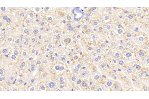 Detection of CEACAM1 in Mouse Liver Tissue using Polyclonal Antibody to Carcinoembryonic Antigen Related Cell Adhesion Molecule 1 (CEACAM1) (CEACAM1 Antikörper  (AA 35-143))