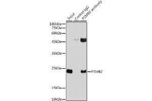 Immunoprecipitation analysis of 300 μg extracts of HeLa cells using 3 μg PSMB2 antibody (ABIN6129441, ABIN6146313, ABIN6146315 and ABIN6217703). (PSMB2 Antikörper  (AA 1-201))