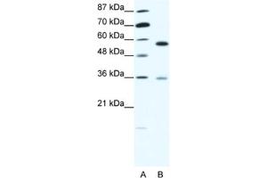 Western Blotting (WB) image for anti-GDP Dissociation Inhibitor 1 (GDI1) antibody (ABIN2463768)