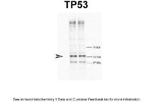 WB Suggested Anti-TP53 Antibody Titration: 1 ug/mlPositive Control: HeLa cells (p53 Antikörper  (N-Term))