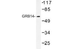 Image no. 1 for anti-Growth Factor Receptor-Bound Protein 14 (GRB14) antibody (ABIN317840) (GRB14 Antikörper)