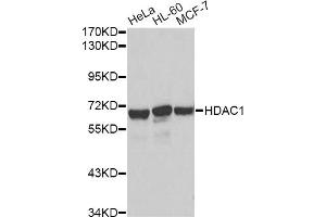 Western blot analysis of extracts of various cell lines, using HDAC1 antibody. (HDAC1 Antikörper)