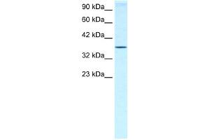 WB Suggested Anti-HOXA7 Antibody Titration:  0. (HOXA7 Antikörper  (N-Term))