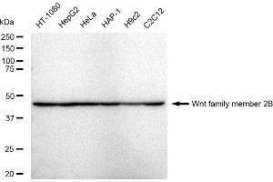 Western blotting analysis using Wnt family member 2B antibody (ABIN7800861).