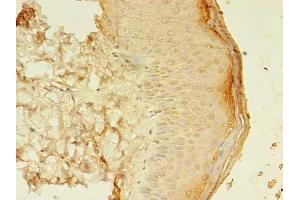 Immunohistochemistry of paraffin-embedded human skin tissue using ABIN7160224 at dilution of 1:100 (SMAD1 Antikörper  (AA 202-335))