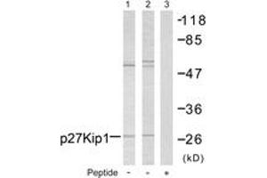 Western blot analysis of extracts from A2780 cells, using p27 Kip1 (Ab-10) Antibody. (CDKN1B Antikörper  (AA 1-50))