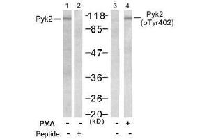 Image no. 2 for anti-PTK2B Protein tyrosine Kinase 2 beta (PTK2B) (pTyr402) antibody (ABIN196952) (PTK2B Antikörper  (pTyr402))