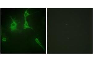 Immunofluorescence analysis of NIH-3T3 cells, using Collagen IX alpha3 Antibody.