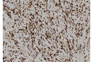 ABIN6277680 at 1/100 staining Human gastric tissue by IHC-P.