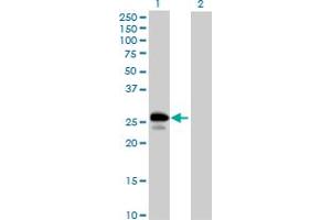Western Blot analysis of UBE2J2 expression in transfected 293T cell line by UBE2J2 MaxPab polyclonal antibody. (UBE2J2 Antikörper  (AA 1-259))