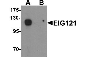 Western blot analysis of EIG121 in MCF7 cell lysate with EIG121 antibody at 1 µg/mL in (A) the absence and (B) the presence of blocking peptide.