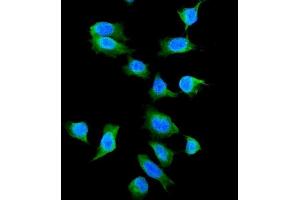IF analysis of Galectin 1 using anti-Galectin 1 antibody (ABIN5518716). (LGALS1/Galectin 1 Antikörper  (AA 2-135))