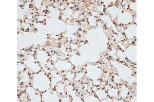 Immunohistochemistry of paraffin-embedded Mouse lung using ZNF141 Polyclonal Antibody at dilution of 1:100 (40x lens). (ZNF141 Antikörper)