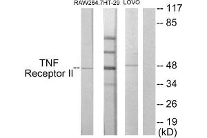 Western blot analysis of extracts from RAW264. (TNFRSF1B Antikörper  (C-Term))