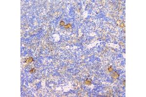 IHC analysis of CD229 using anti-CD229 antibody (ABIN6719290).