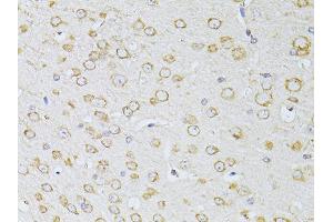 Immunohistochemistry of paraffin-embedded mouse brain using NTS antibody (ABIN5998396) at dilution of 1/100 (40x lens). (Neurotensin Antikörper)