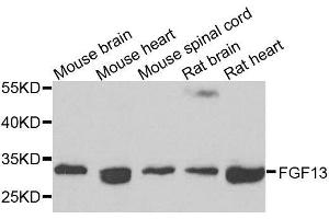 Western blot analysis of extracts of various cell lines, using FGF13 antibody. (FGF13 Antikörper  (AA 1-245))