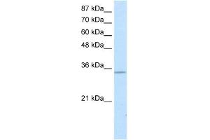 Western Blotting (WB) image for anti-Snail Family Zinc Finger 2 (SNAI2) (Middle Region) antibody (ABIN2777851)